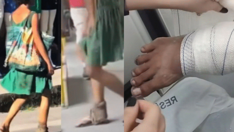 ‘Mulher do pé podre’ recebe curativo após viralizar na web; veja vídeo